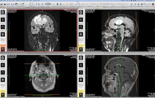 DICOM viewer iOS