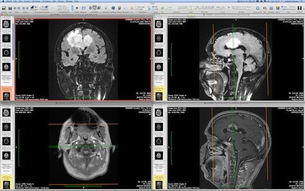 DICOM viewer iOS