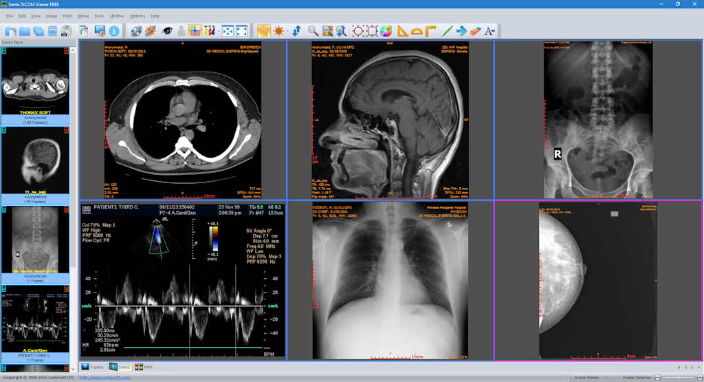 DICOM viewer iOS